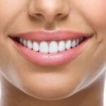 لکه گیری دندان چیست؟