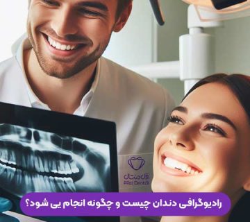 رادیوگرافی دندان چیست و چگونه انجام می شود؟