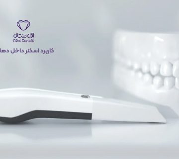 کاربرد اسکنر داخل دهانی
