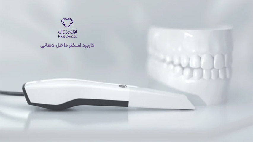 کاربرد اسکنر داخل دهانی