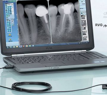 قیمت دستگاه سنسور RVG