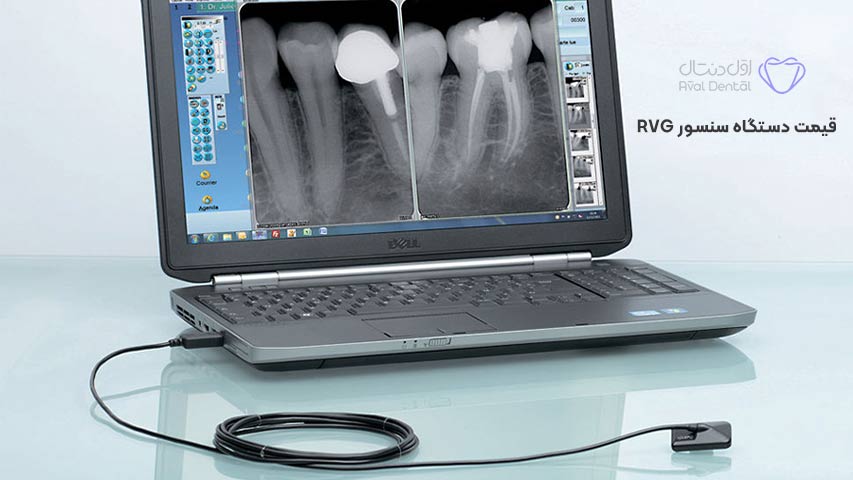 قیمت دستگاه سنسور RVG