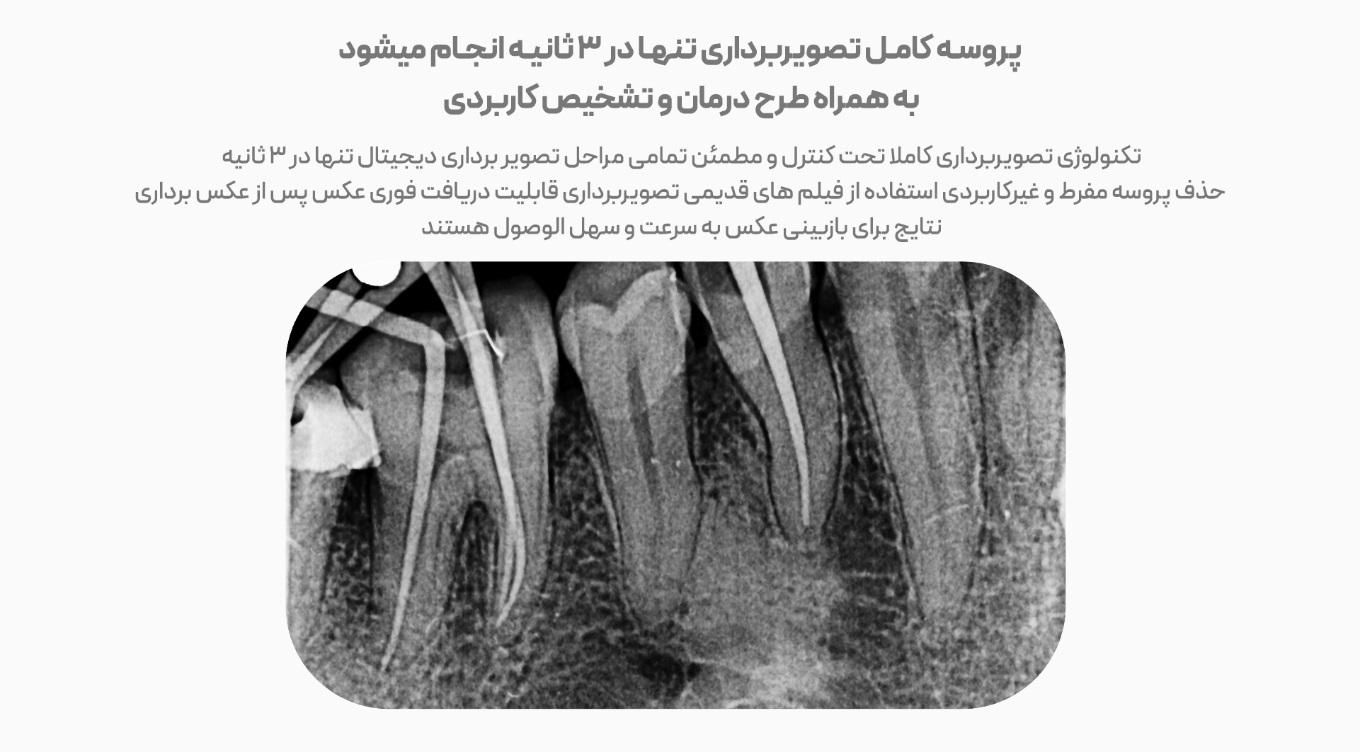 سنسور RVG وودپیکر مدل i-Sensor