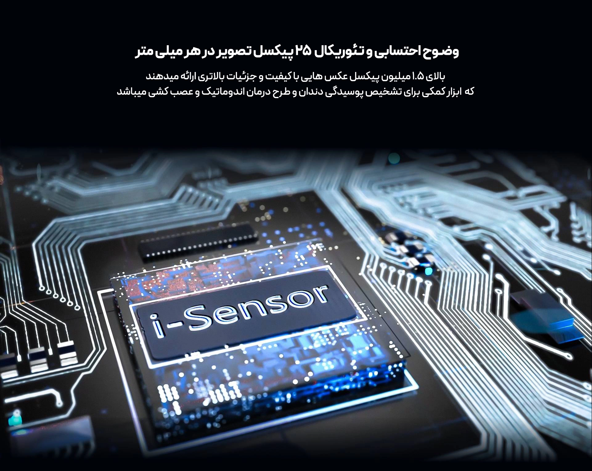 سنسور RVG وودپیکر مدل i-Sensor