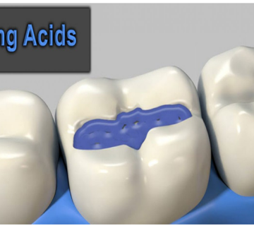 دیدگاه های فعلی در مورد چسبندگی دندان