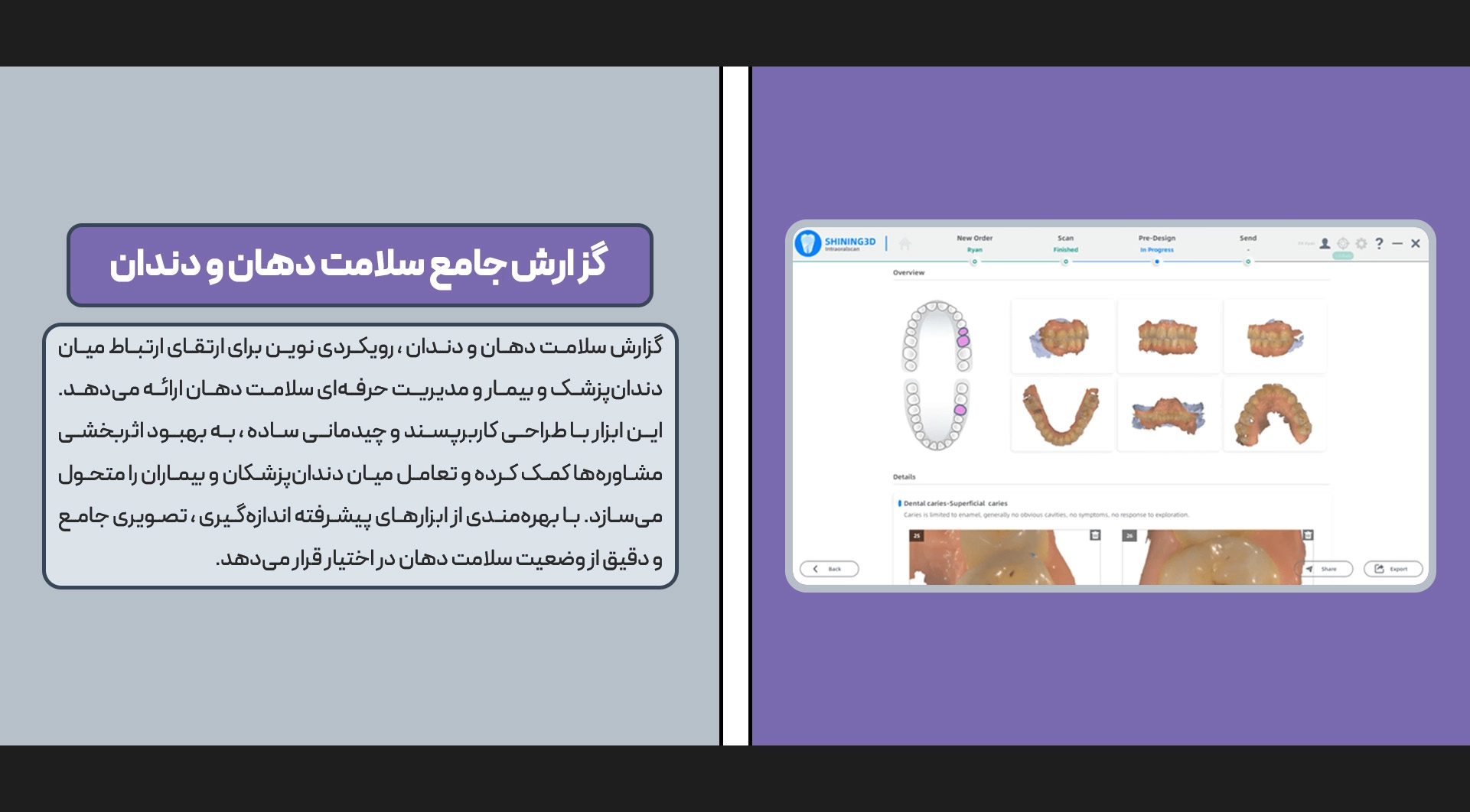 اسکنر داخل دهانی Aoralscan 3