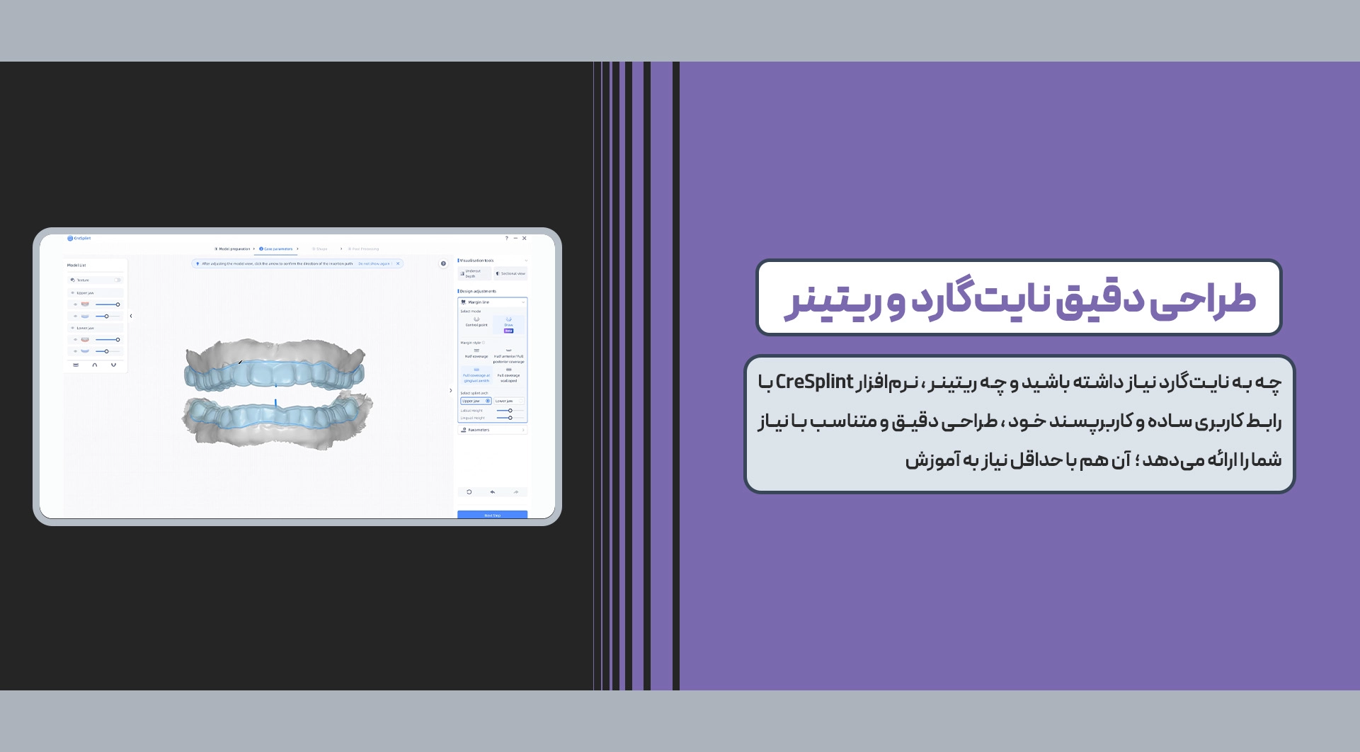 اسکنر داخل دهانی Aoralscan 3