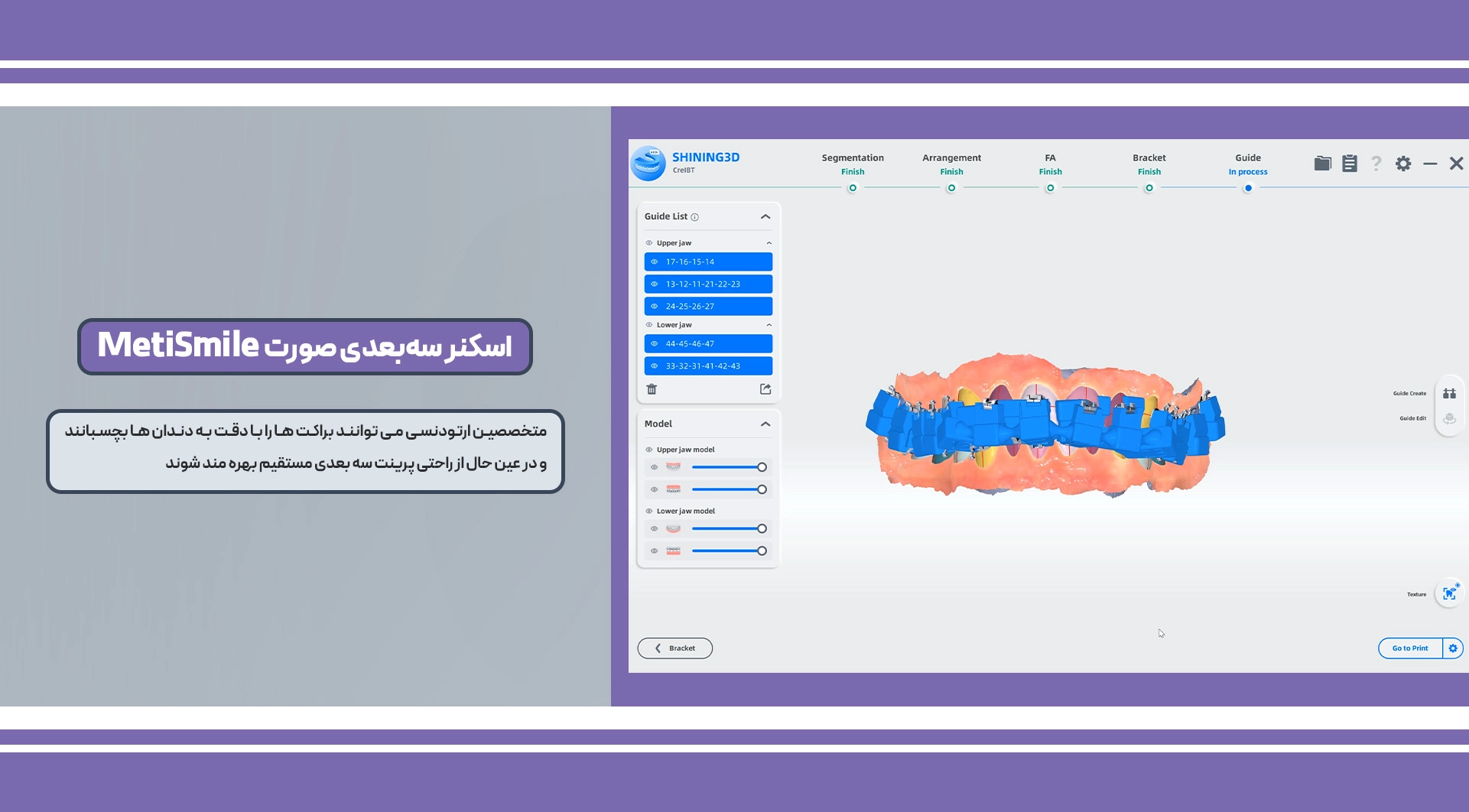 اسکنر داخل دهانی Aoralscan 3