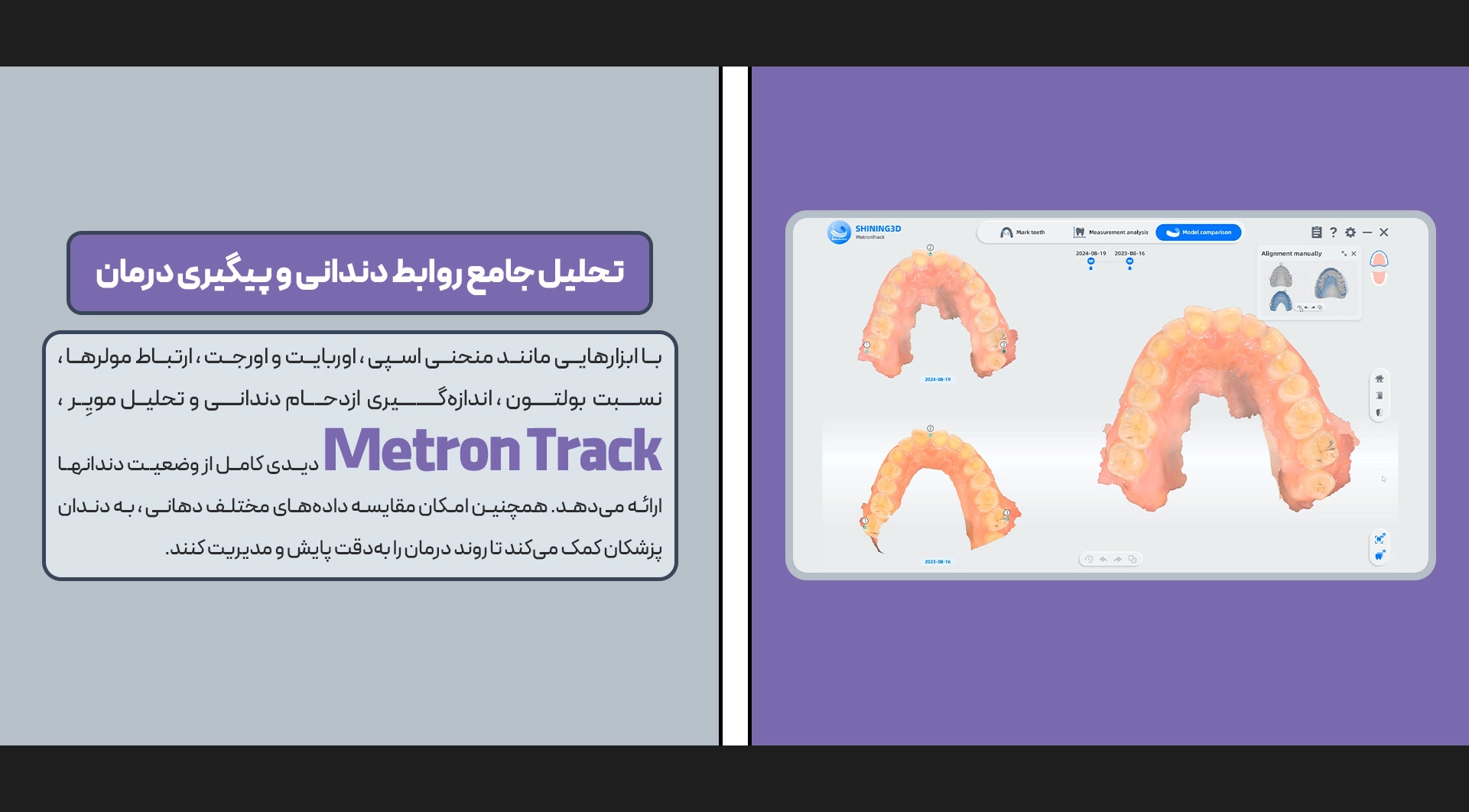 اسکنر داخل دهانی Aoralscan 3