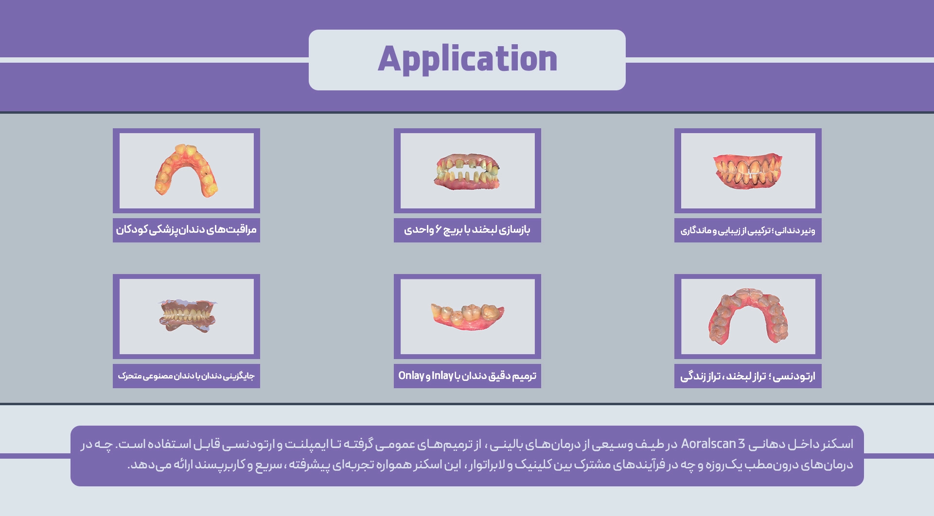اسکنر داخل دهانی Aoralscan 3