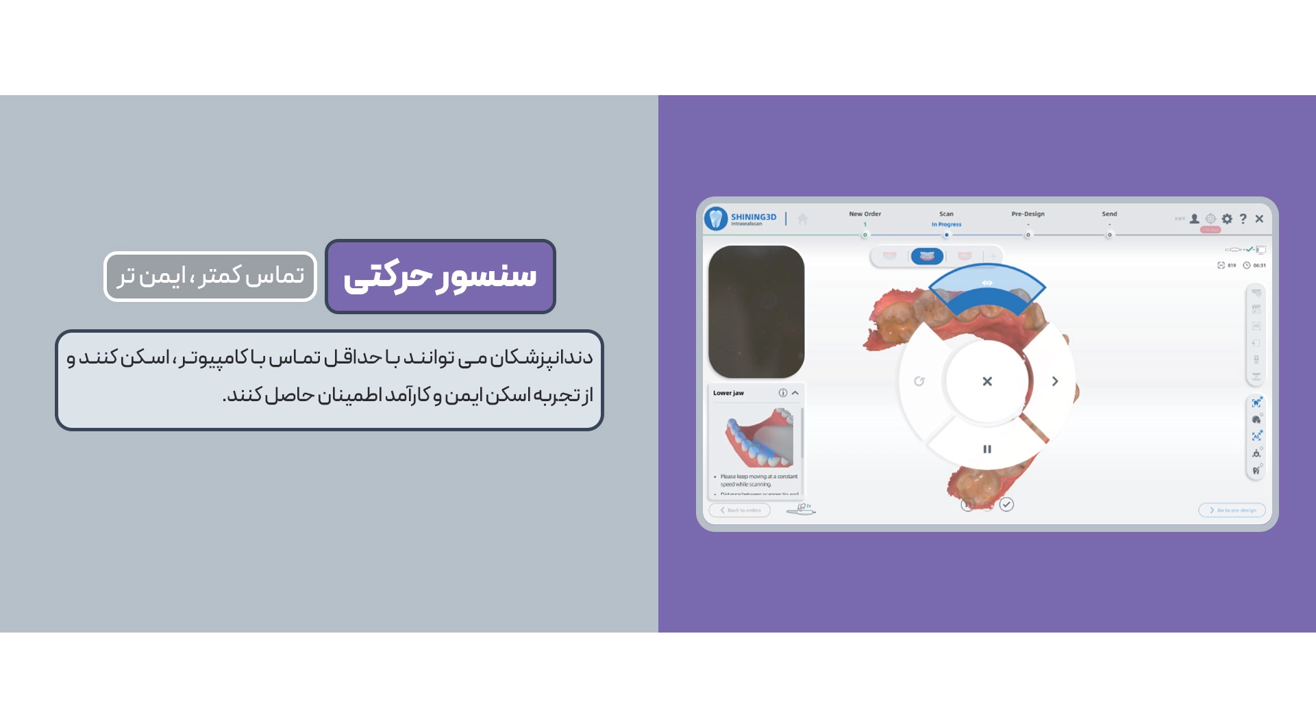 اسکنر داخل دهانی Aoralscan 3