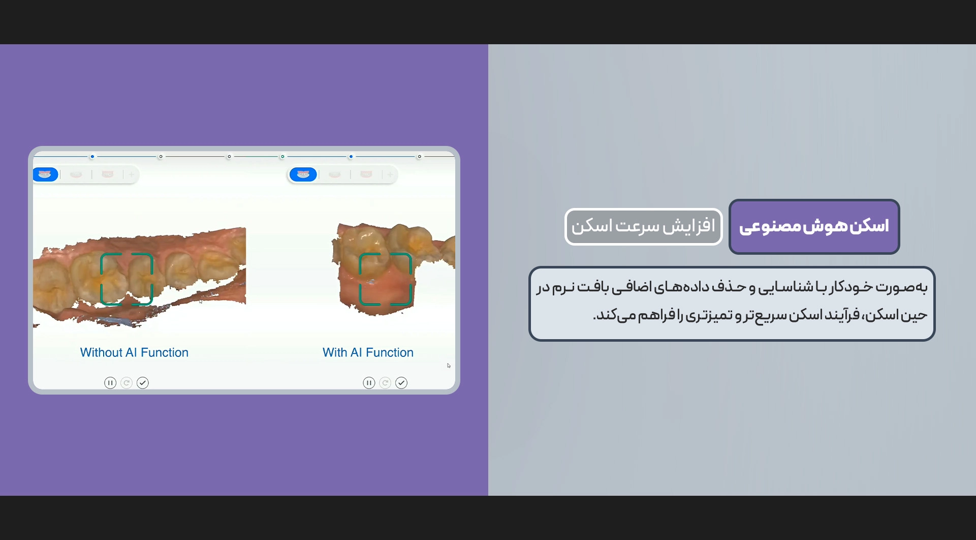 اسکنر داخل دهانی Aoralscan 3