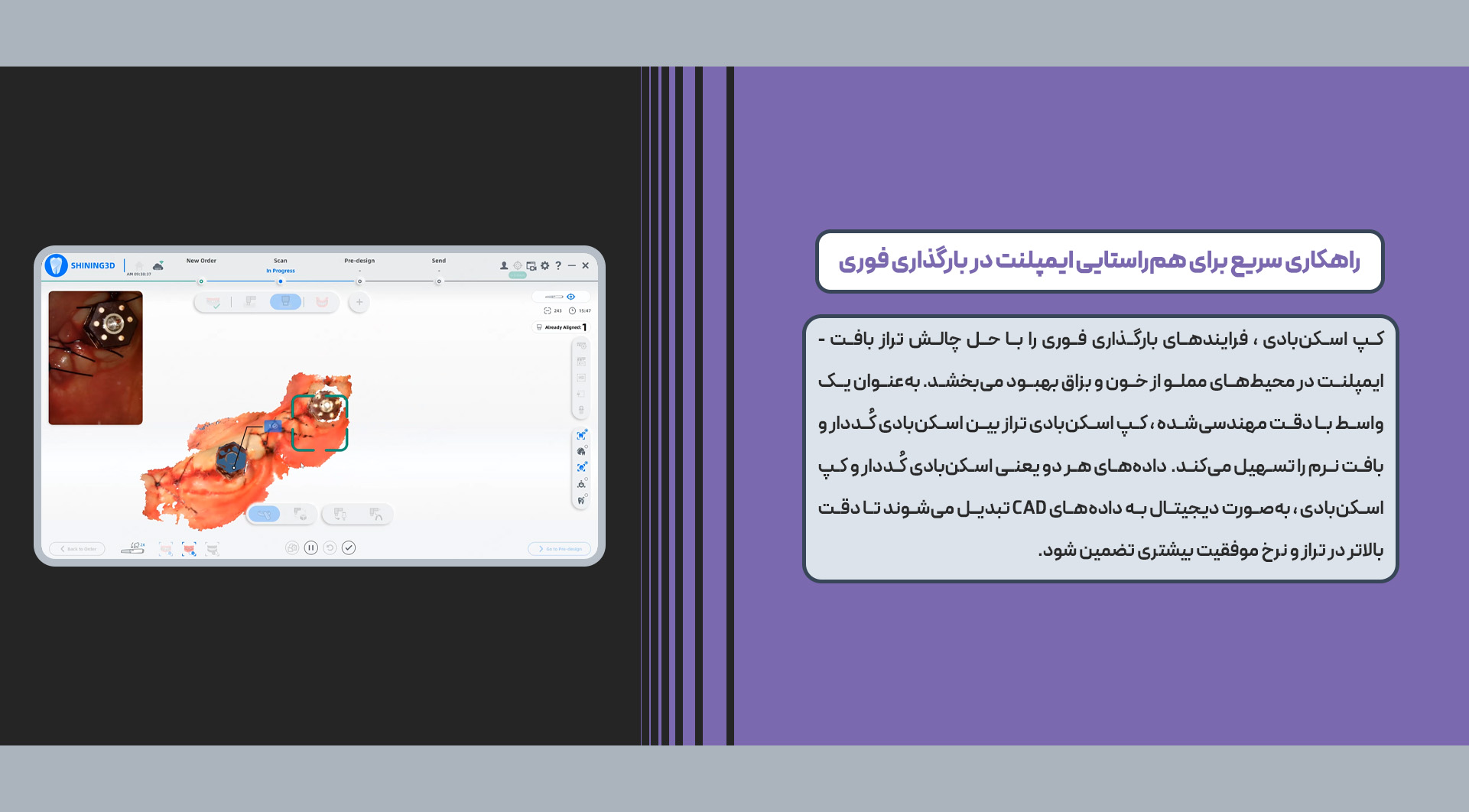 اسکنر داخل دهانی Aoral Scan Elite