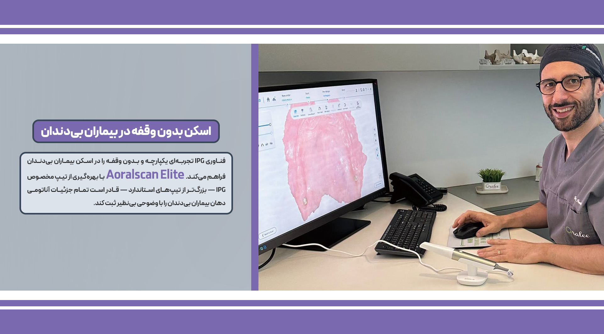اسکنر داخل دهانی Aoral Scan Elite