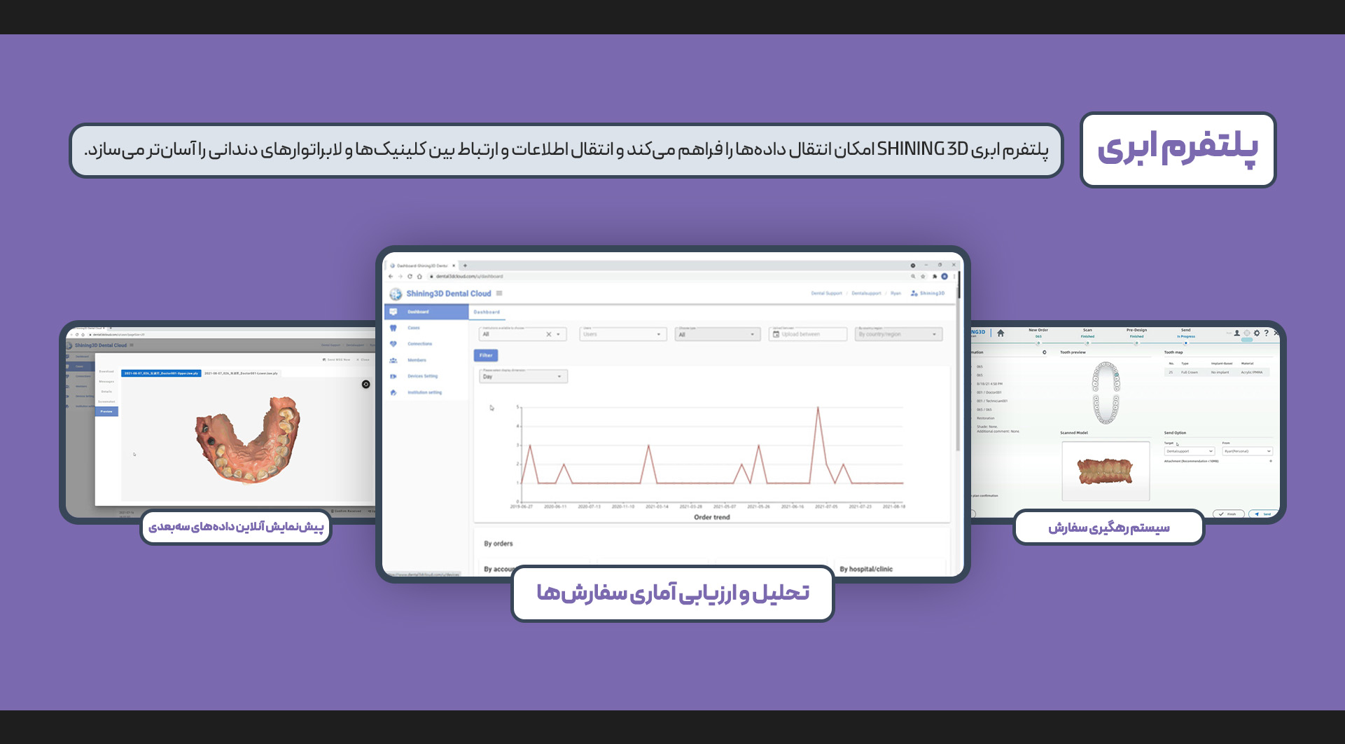 اسکنر داخل دهانی Aoral Scan Elite